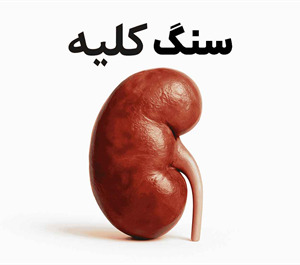 هرچی که از سنگ کلیه باید بدونی